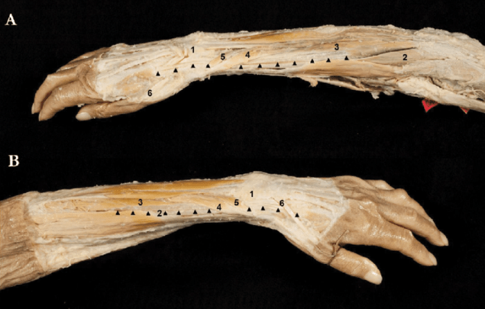 Extensor carpi radialis longus cadaver