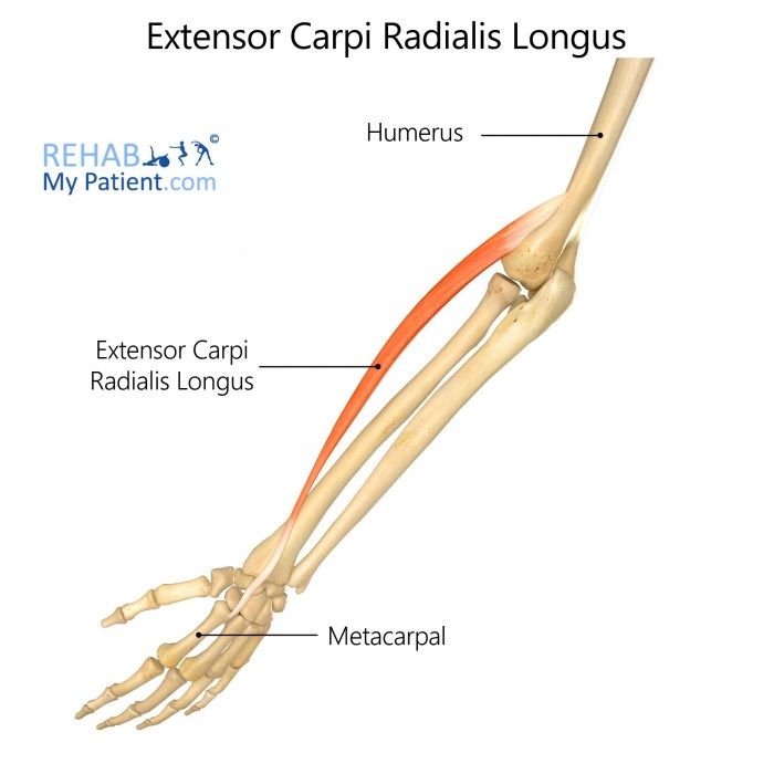 Extensor carpi radialis longus cadaver